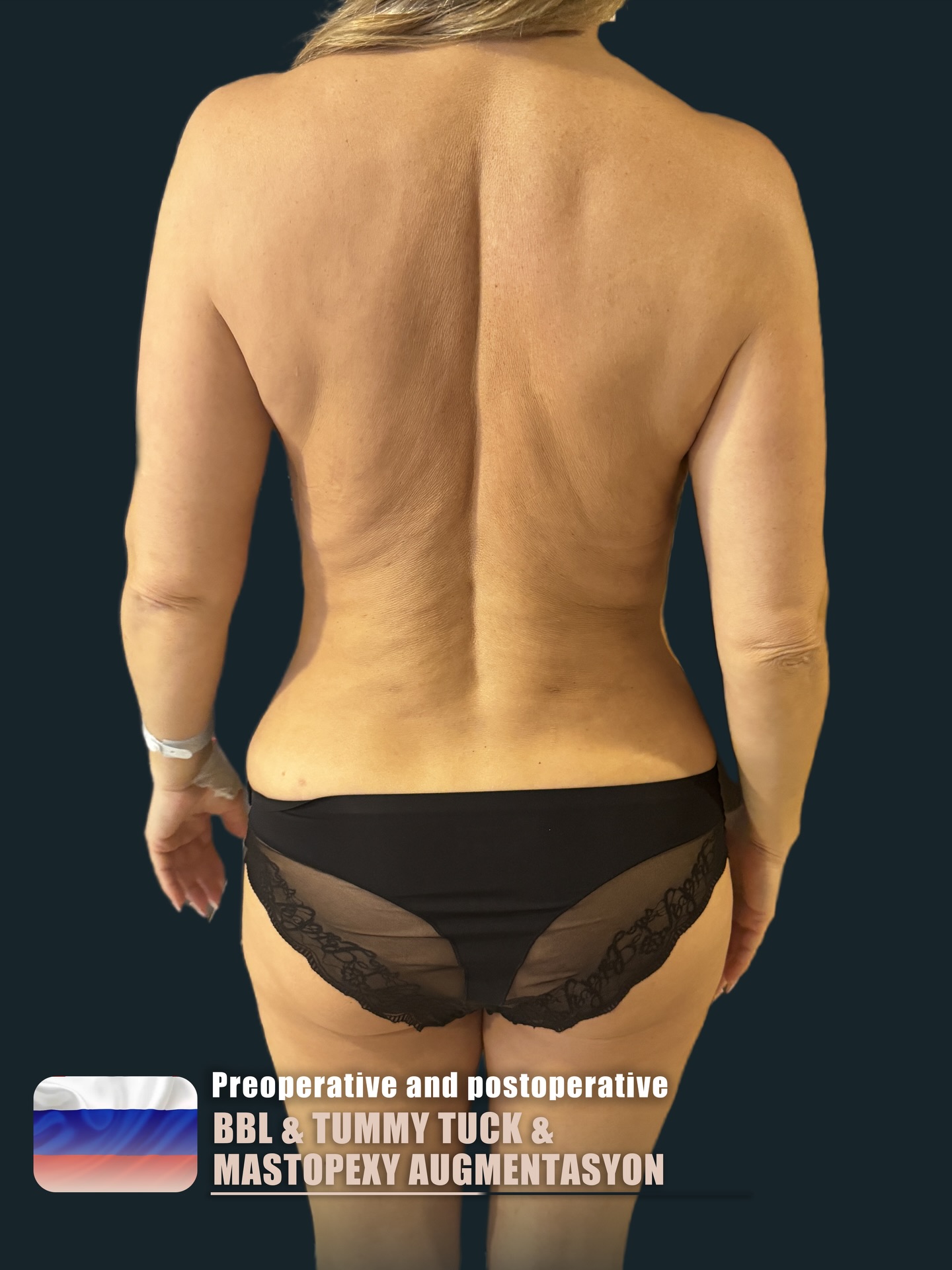 Recovery support image